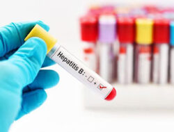 Pakar Desak Pemerintah Cepat Deteksi Hepatitis Akut Misterius