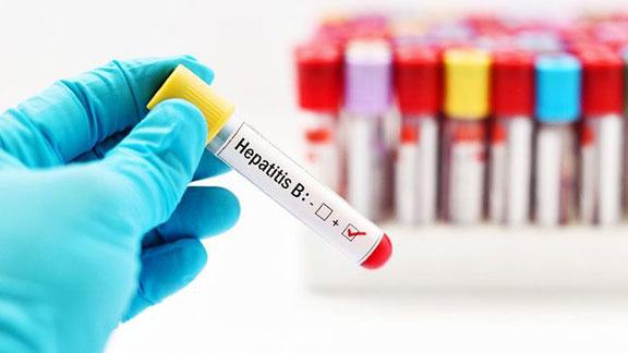 hepatitis